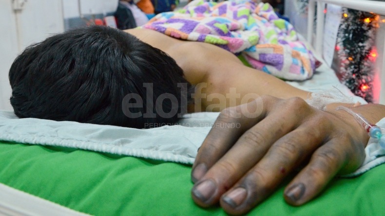 Menor de 14 años resultó quemado por pólvora en Ibagué